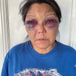 Diné woman brutally attacked after night shift