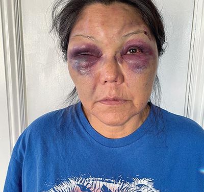 Diné woman brutally attacked after night shift